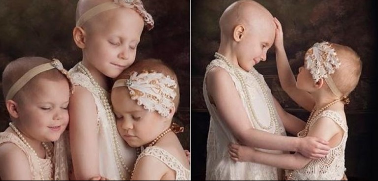 Las niñas con cáncer de la fotografía viral en la red